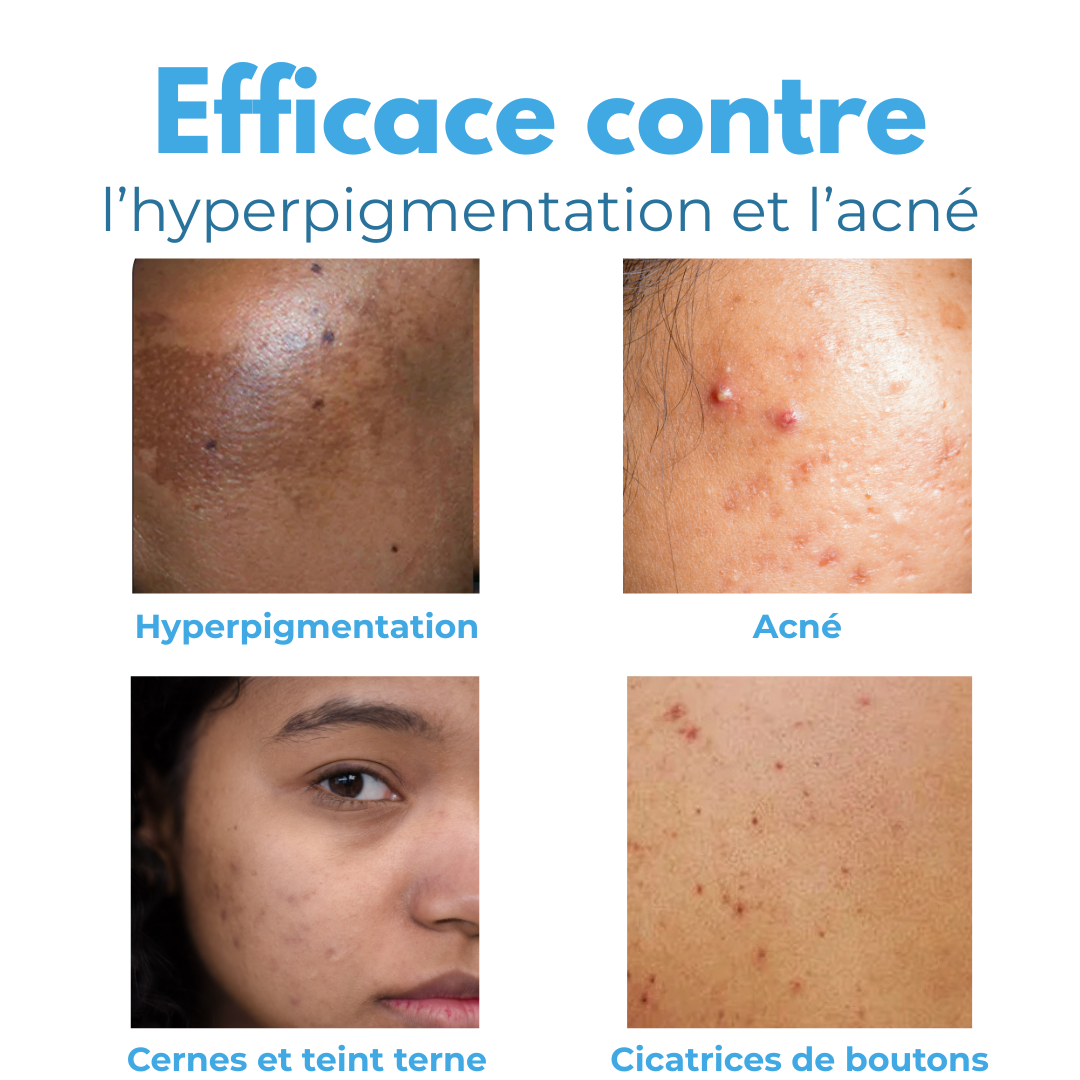 Masque au Nila